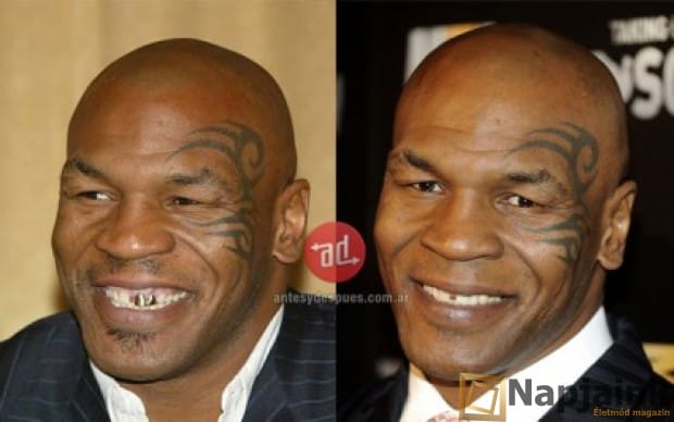 asp_620_mosoly_Mike-Tyson